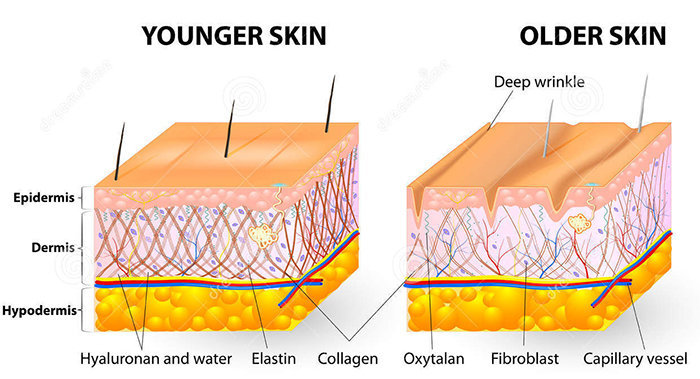 Sự khác biệt giữa da suy giảm lượng lớn collagen và da khi còn trẻ